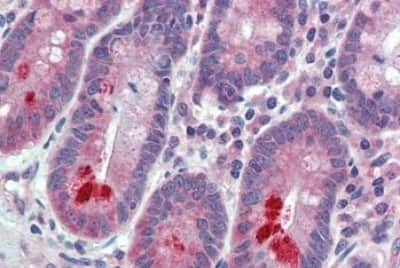 Immunohistochemistry-Paraffin: FAM62A Antibody [NBP3-14562] - Immunohistochemistry of formalin-fixed, paraffin-embedded human small intestine tissue after heat-induced antigen retrieval.